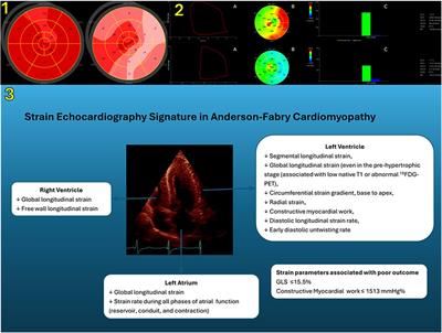 Cardiac involvement in Anderson–Fabry disease. The role of advanced echocardiography